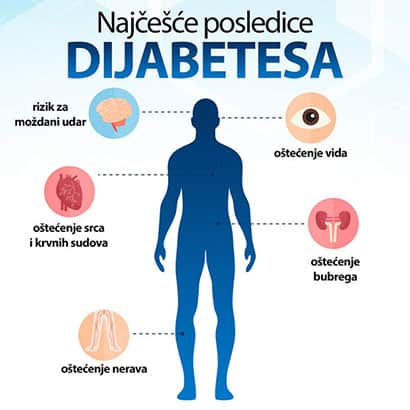 najcesce-posledice-dijabetesa