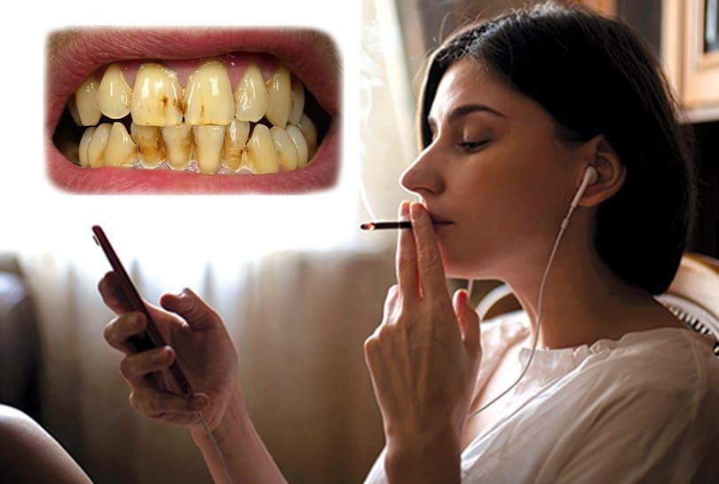 kako ocistiti zube od nikotina