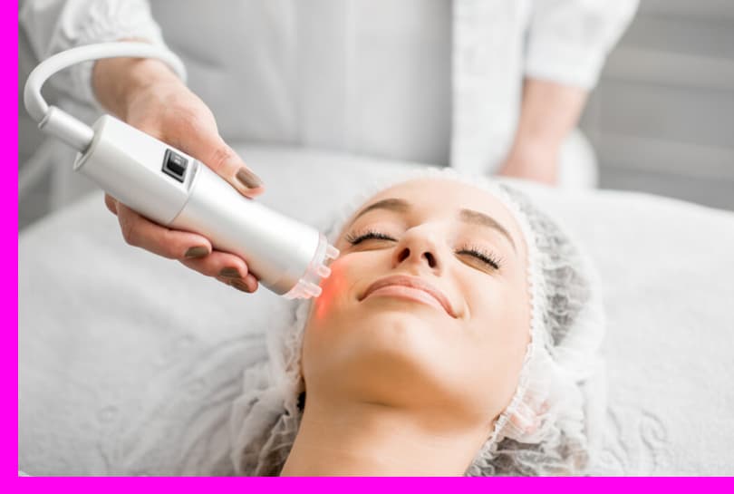 Bitne stvari koje treba znati pre laserskog podmlađivanje i zatezanje kože 3 laserski tretmani lica slika
